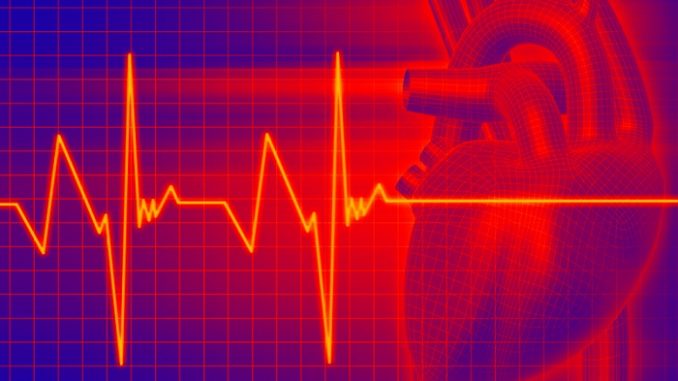 Тахикардия вызывает осложнения Тахикардия вызывает осложнения